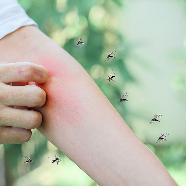 Mosquitos2 Person scratching a red, irritated forearm bite with several mosquitoes nearby